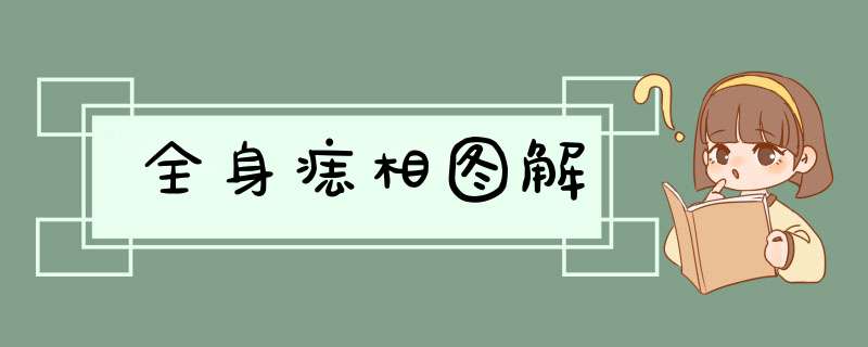 全身痣相图解
