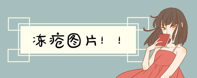 冻疮图片！！