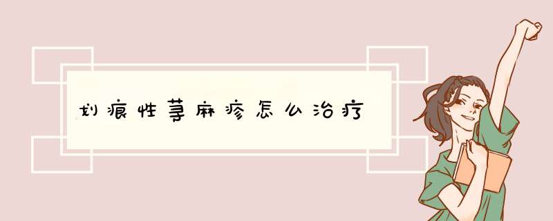 划痕性荨麻疹怎么治疗