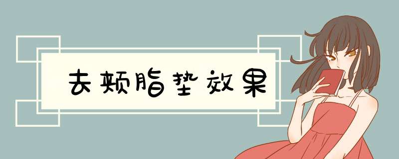 去颊脂垫效果