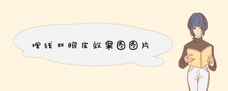 埋线双眼皮效果图图片