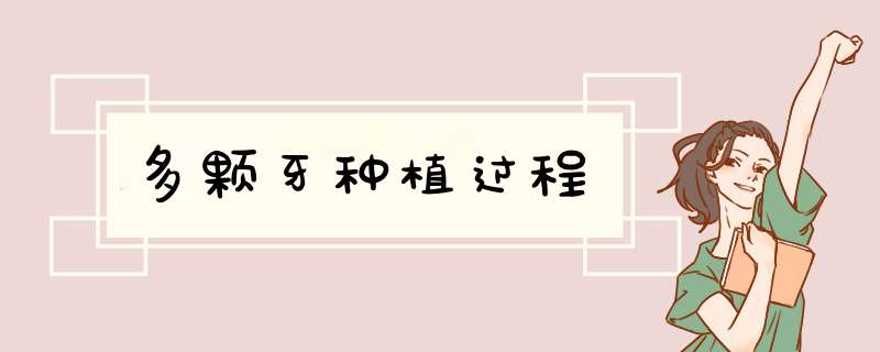 多颗牙种植过程
