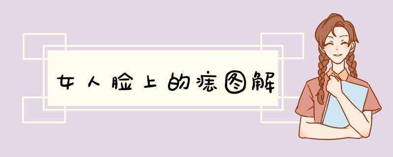 女人脸上的痣图解