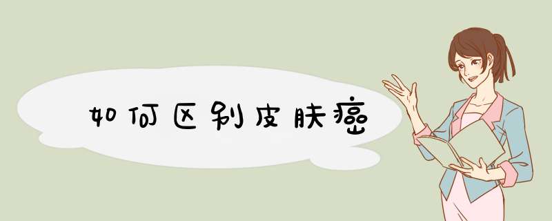 如何区别皮肤癌