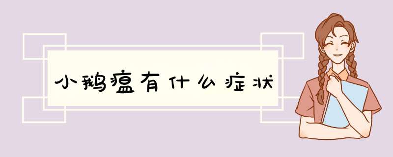 小鹅瘟有什么症状