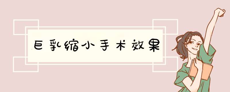 巨乳缩小手术效果