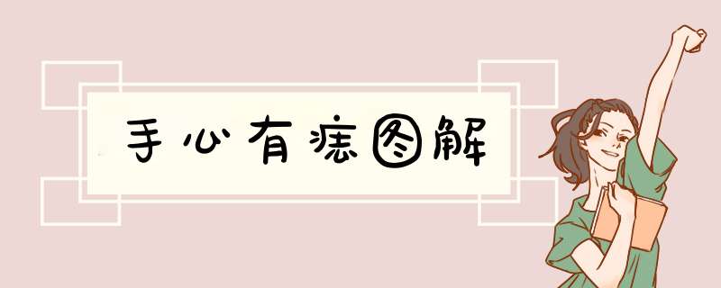 手心有痣图解