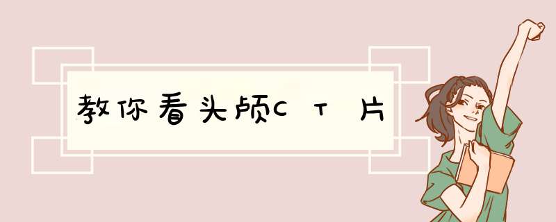 教你看头颅CT片