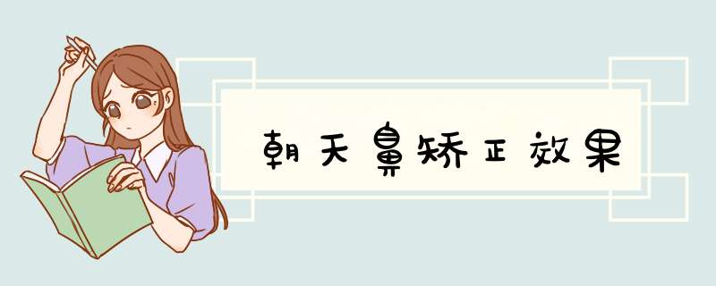 朝天鼻矫正效果