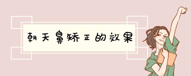 朝天鼻矫正的效果