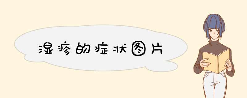 湿疹的症状图片