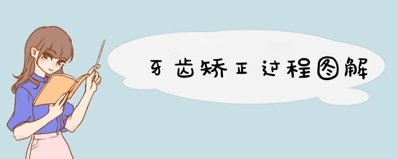 牙齿矫正过程图解