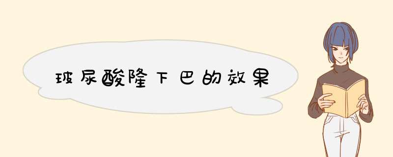 玻尿酸隆下巴的效果
