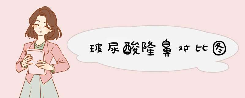 玻尿酸隆鼻对比图