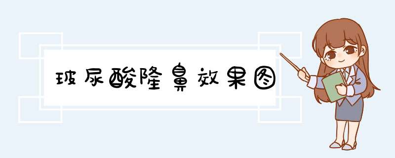 玻尿酸隆鼻效果图