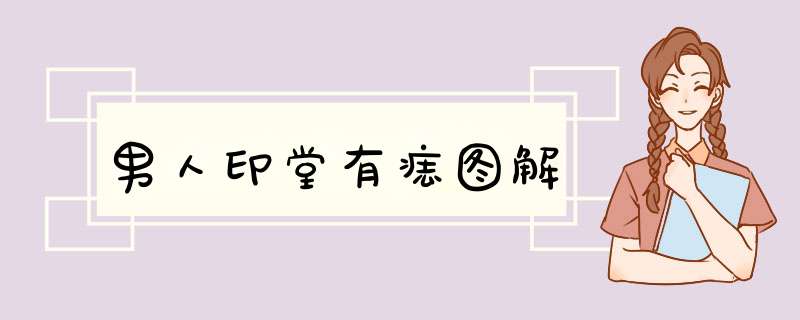 男人印堂有痣图解