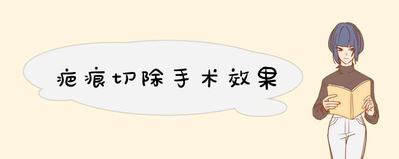 疤痕切除手术效果