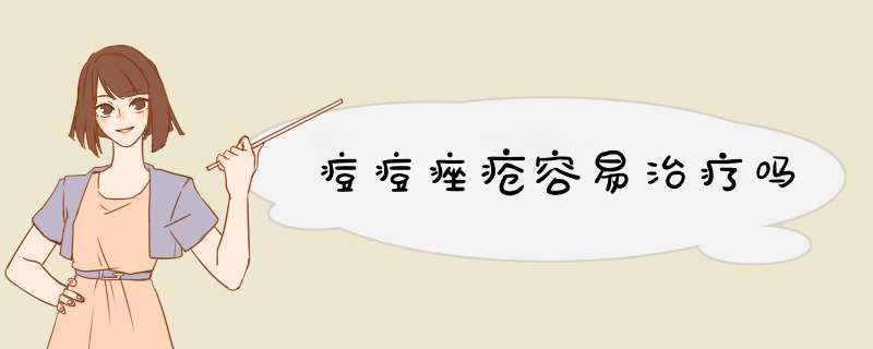 痘痘痤疮容易治疗吗