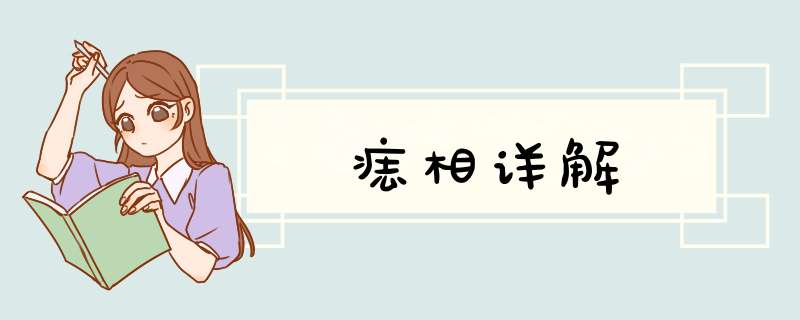 痣相详解