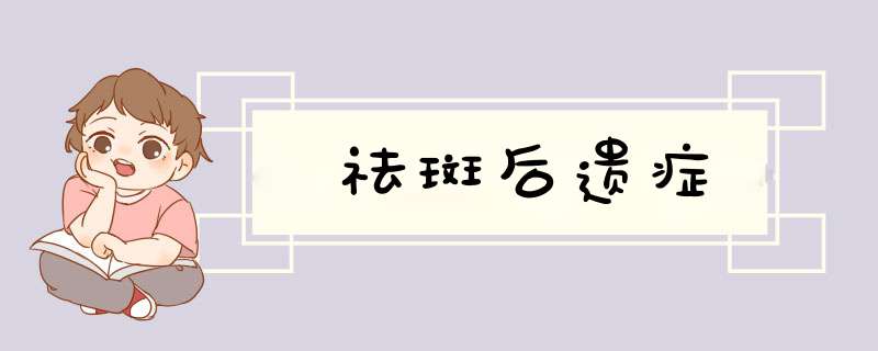 祛斑后遗症