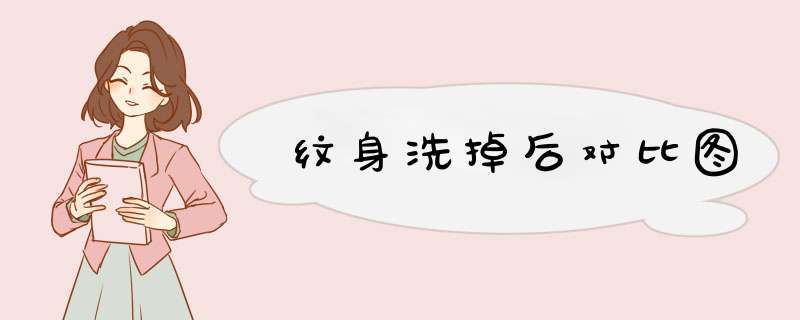 纹身洗掉后对比图