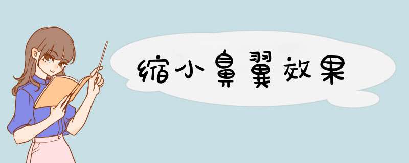 缩小鼻翼效果