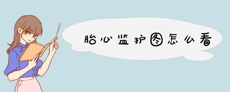 胎心监护图怎么看
