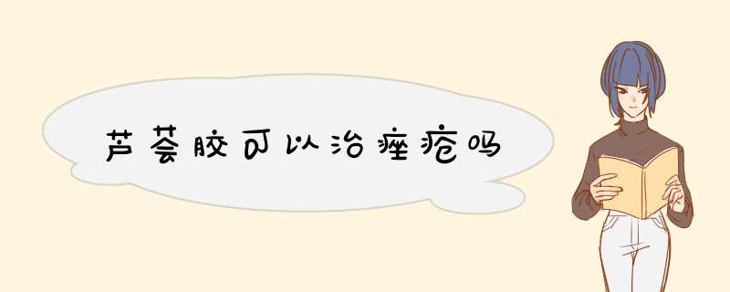 芦荟胶可以治痤疮吗