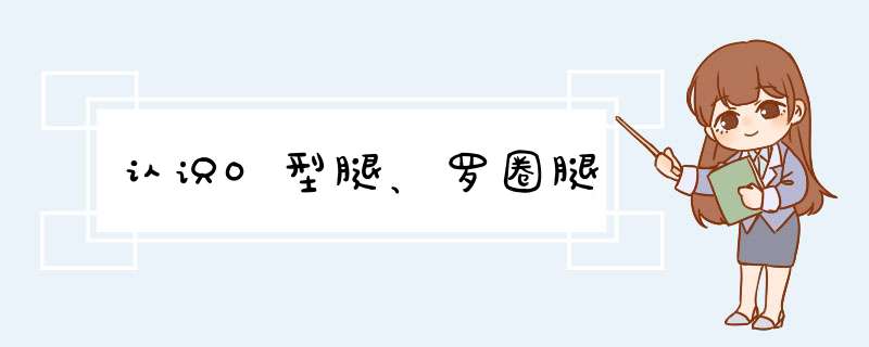 认识O型腿、罗圈腿