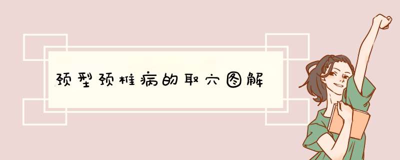 颈型颈椎病的取穴图解
