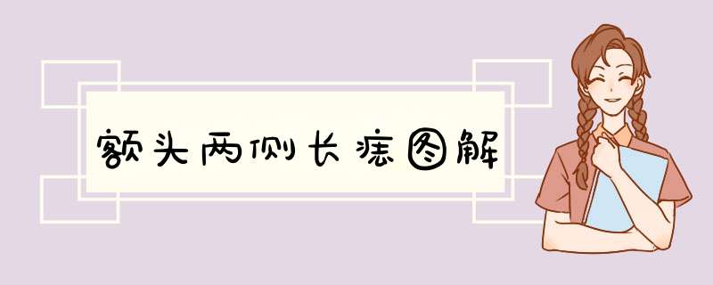 额头两侧长痣图解