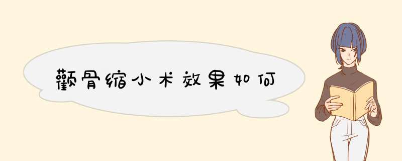 颧骨缩小术效果如何