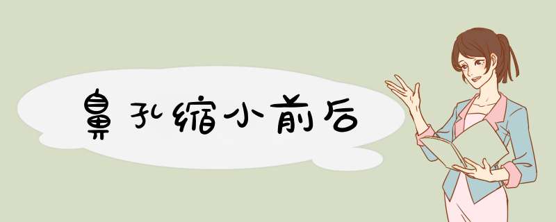 鼻孔缩小前后