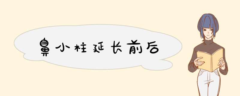 鼻小柱延长前后
