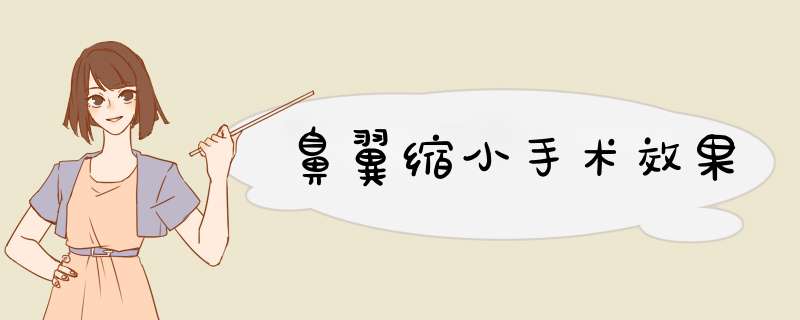 鼻翼缩小手术效果